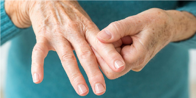 Rheumatoid arthritis and CBD